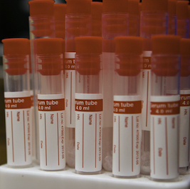 Label printing in Cornwall for all types metalic serial numbers printed labels.