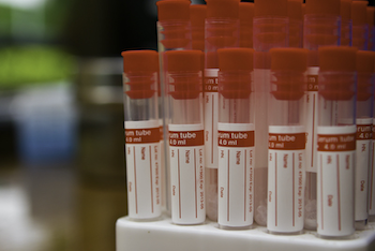 QR labels for test tubes and many other options for products.